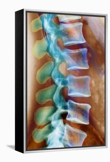 Healthy Lower Spine, X-ray-Science Photo Library-Framed Premier Image Canvas