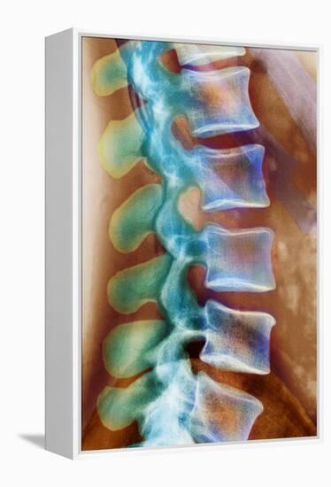 Healthy Lower Spine, X-ray-Science Photo Library-Framed Premier Image Canvas