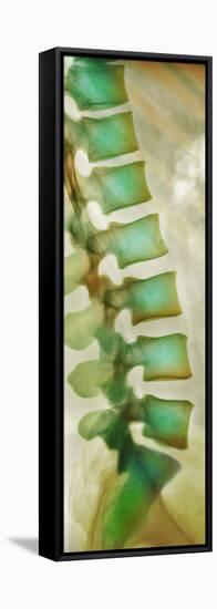 Healthy Lower Spine, X-ray-Science Photo Library-Framed Premier Image Canvas