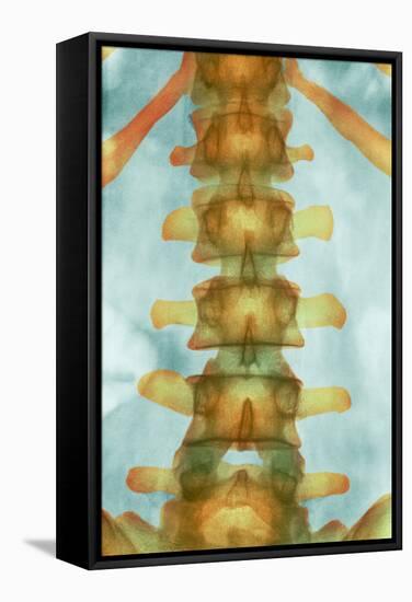 Healthy Lower Spine, X-ray-Science Photo Library-Framed Premier Image Canvas