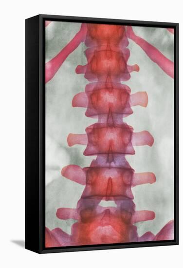 Healthy Lower Spine, X-ray-Science Photo Library-Framed Premier Image Canvas