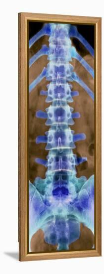 Healthy Lower Spine, X-ray-Science Photo Library-Framed Premier Image Canvas