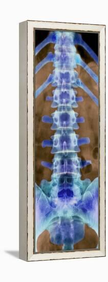 Healthy Lower Spine, X-ray-Science Photo Library-Framed Premier Image Canvas