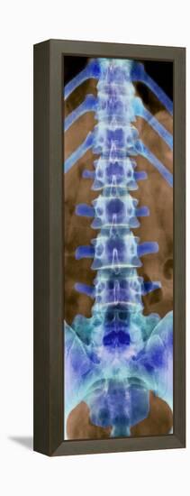 Healthy Lower Spine, X-ray-Science Photo Library-Framed Premier Image Canvas