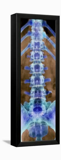 Healthy Lower Spine, X-ray-Science Photo Library-Framed Premier Image Canvas