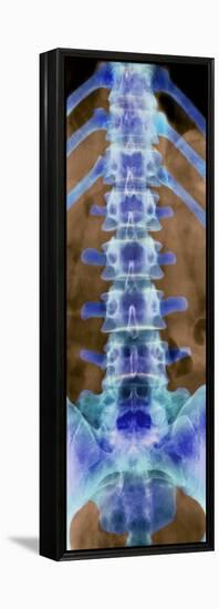 Healthy Lower Spine, X-ray-Science Photo Library-Framed Premier Image Canvas