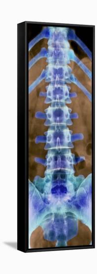 Healthy Lower Spine, X-ray-Science Photo Library-Framed Premier Image Canvas