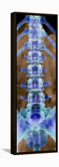 Healthy Lower Spine, X-ray-Science Photo Library-Framed Premier Image Canvas