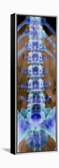 Healthy Lower Spine, X-ray-Science Photo Library-Framed Premier Image Canvas