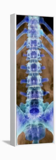 Healthy Lower Spine, X-ray-Science Photo Library-Framed Premier Image Canvas