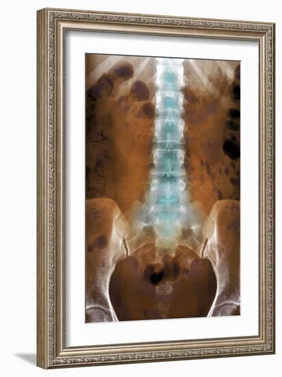 Healthy Lower Spine, X-ray-Du Cane Medical-Framed Photographic Print