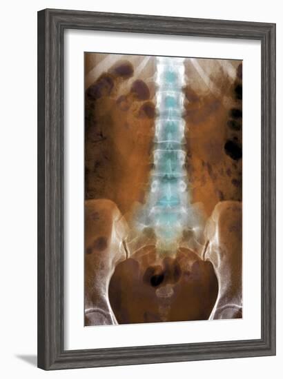 Healthy Lower Spine, X-ray-Du Cane Medical-Framed Photographic Print