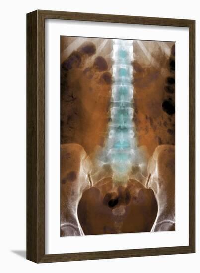 Healthy Lower Spine, X-ray-Du Cane Medical-Framed Photographic Print