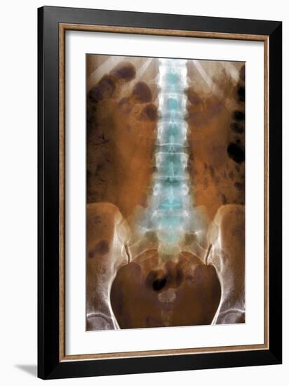 Healthy Lower Spine, X-ray-Du Cane Medical-Framed Photographic Print