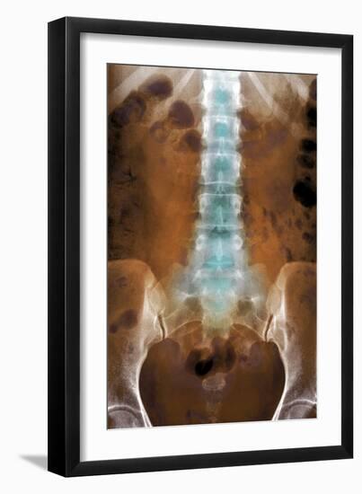 Healthy Lower Spine, X-ray-Du Cane Medical-Framed Photographic Print