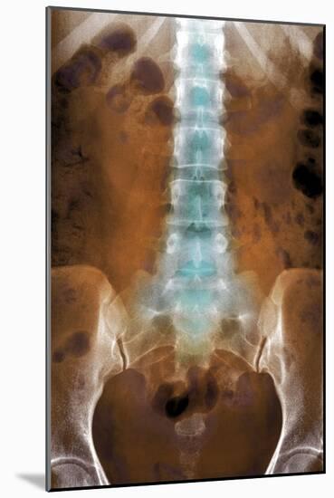 Healthy Lower Spine, X-ray-Du Cane Medical-Mounted Photographic Print