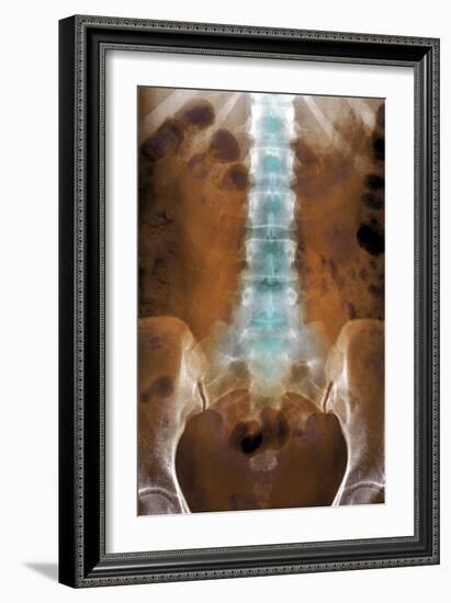 Healthy Lower Spine, X-ray-Du Cane Medical-Framed Photographic Print