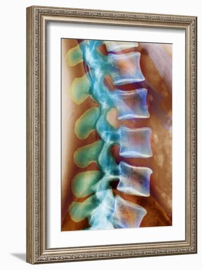 Healthy Lower Spine, X-ray-Science Photo Library-Framed Photographic Print