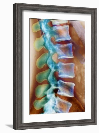 Healthy Lower Spine, X-ray-Science Photo Library-Framed Photographic Print