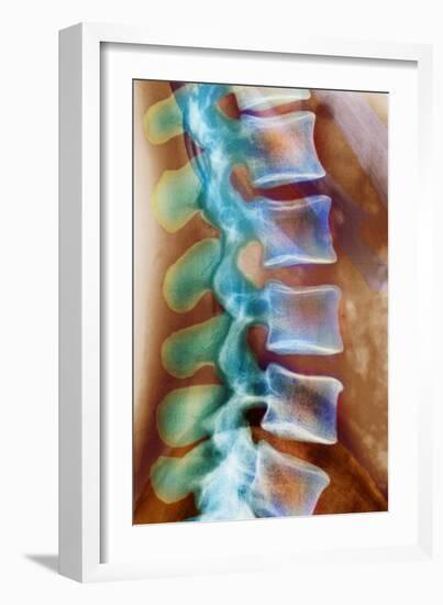 Healthy Lower Spine, X-ray-Science Photo Library-Framed Photographic Print