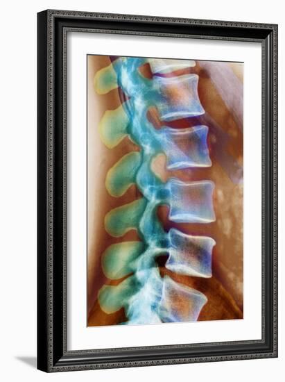 Healthy Lower Spine, X-ray-Science Photo Library-Framed Photographic Print