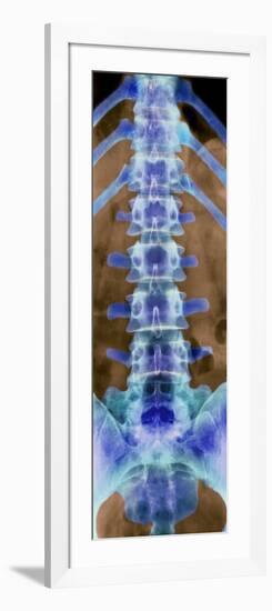 Healthy Lower Spine, X-ray-Science Photo Library-Framed Photographic Print