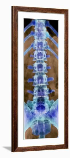 Healthy Lower Spine, X-ray-Science Photo Library-Framed Photographic Print