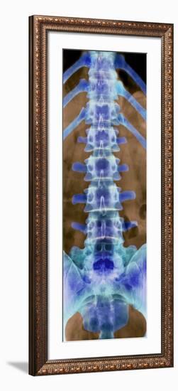 Healthy Lower Spine, X-ray-Science Photo Library-Framed Photographic Print