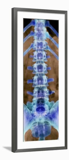 Healthy Lower Spine, X-ray-Science Photo Library-Framed Photographic Print