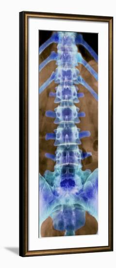 Healthy Lower Spine, X-ray-Science Photo Library-Framed Photographic Print