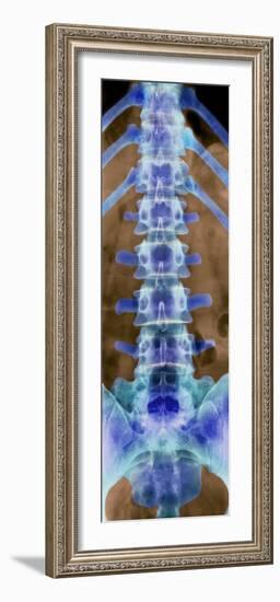 Healthy Lower Spine, X-ray-Science Photo Library-Framed Photographic Print