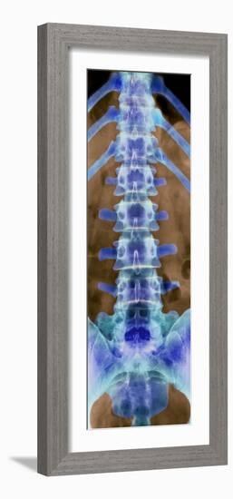 Healthy Lower Spine, X-ray-Science Photo Library-Framed Photographic Print