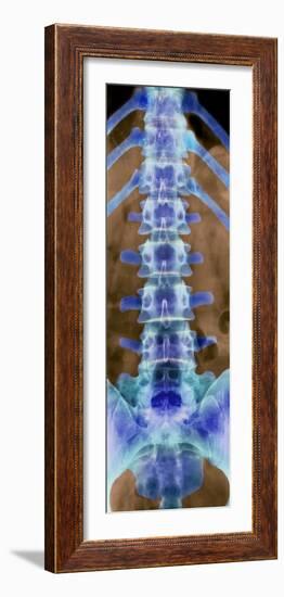 Healthy Lower Spine, X-ray-Science Photo Library-Framed Photographic Print