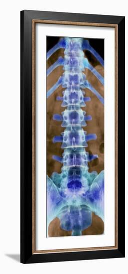 Healthy Lower Spine, X-ray-Science Photo Library-Framed Photographic Print