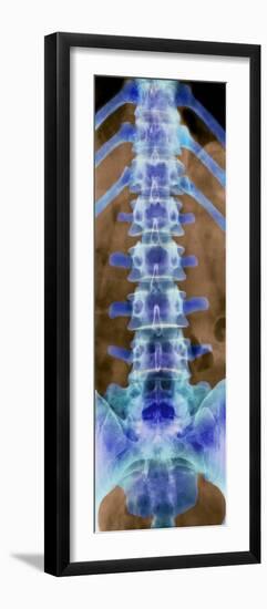 Healthy Lower Spine, X-ray-Science Photo Library-Framed Photographic Print