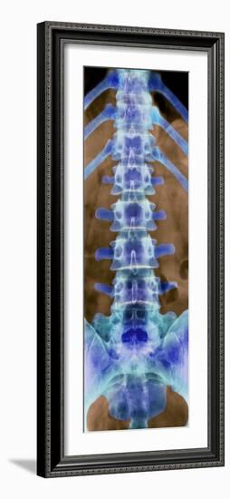 Healthy Lower Spine, X-ray-Science Photo Library-Framed Photographic Print