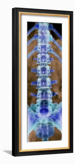 Healthy Lower Spine, X-ray-Science Photo Library-Framed Photographic Print