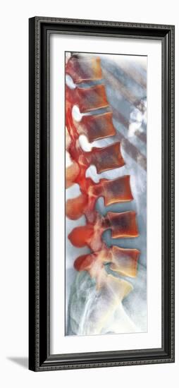 Healthy Lower Spine, X-ray-Science Photo Library-Framed Photographic Print