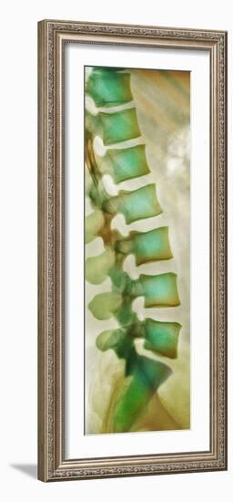 Healthy Lower Spine, X-ray-Science Photo Library-Framed Photographic Print