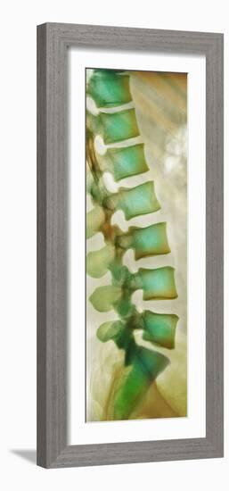 Healthy Lower Spine, X-ray-Science Photo Library-Framed Photographic Print