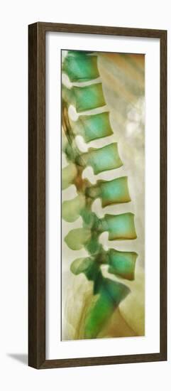 Healthy Lower Spine, X-ray-Science Photo Library-Framed Photographic Print