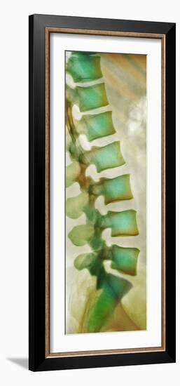 Healthy Lower Spine, X-ray-Science Photo Library-Framed Photographic Print