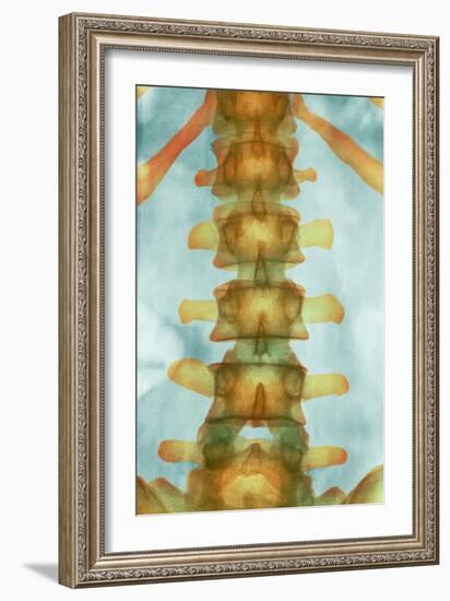 Healthy Lower Spine, X-ray-Science Photo Library-Framed Photographic Print