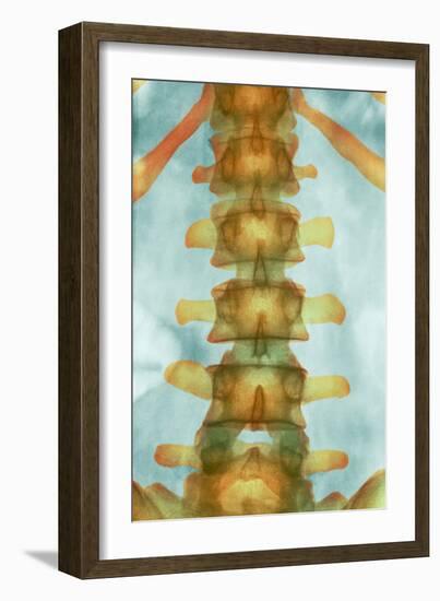 Healthy Lower Spine, X-ray-Science Photo Library-Framed Photographic Print