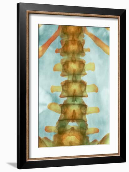 Healthy Lower Spine, X-ray-Science Photo Library-Framed Photographic Print