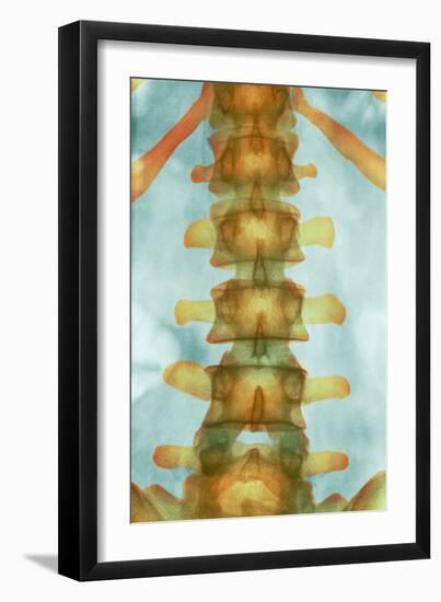 Healthy Lower Spine, X-ray-Science Photo Library-Framed Photographic Print