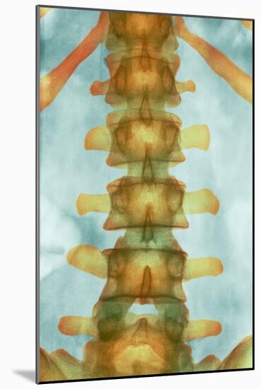 Healthy Lower Spine, X-ray-Science Photo Library-Mounted Photographic Print
