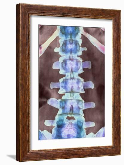 Healthy Lower Spine, X-ray-Science Photo Library-Framed Photographic Print