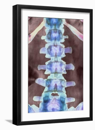 Healthy Lower Spine, X-ray-Science Photo Library-Framed Photographic Print