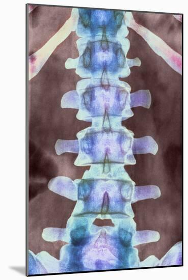 Healthy Lower Spine, X-ray-Science Photo Library-Mounted Photographic Print